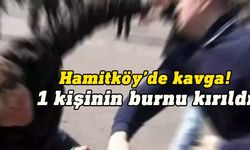 Hamitköy’de çıkan kavgada bir kişinin burnu kırıldı